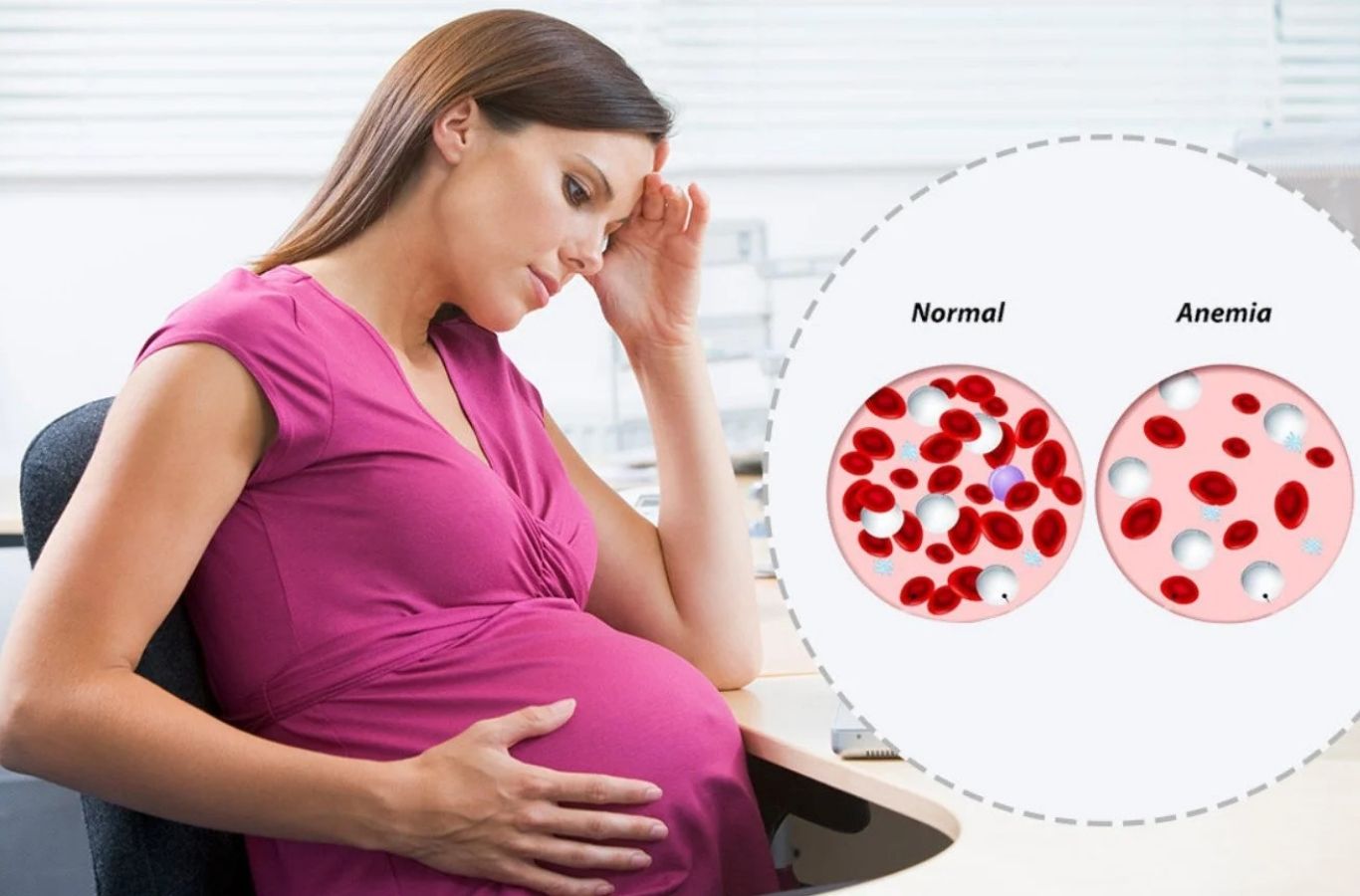 bơ giúp phòng ngừa thiếu máu